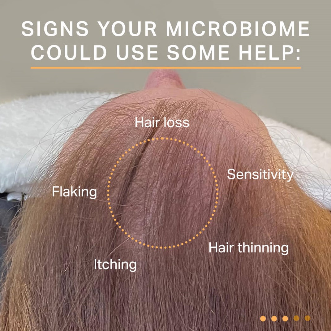 Signs your microbiome could us